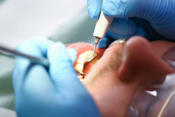 Best Cosmetic Emergency Dentistry in Irvine, KY