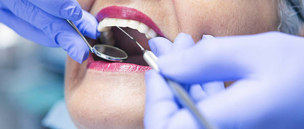 Best Emergency Dental Care for Broken or Chipped Teeth in Irvine, KY